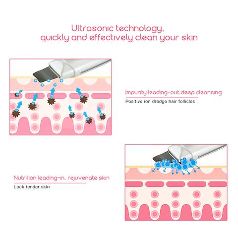 Ultrasonic Skin Scrubber